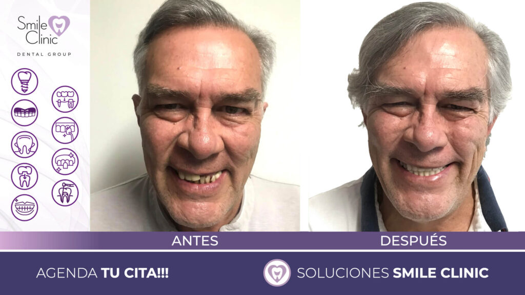 FOTOS ANTES Y DESPUES 2023.001