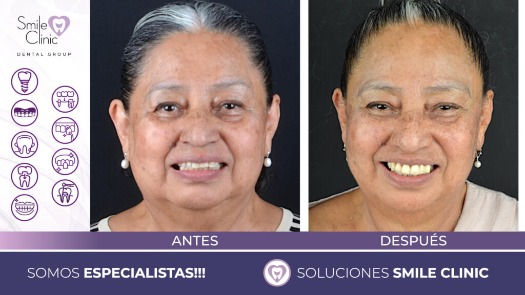 FOTOS ANTES Y DESPUES 2023.002