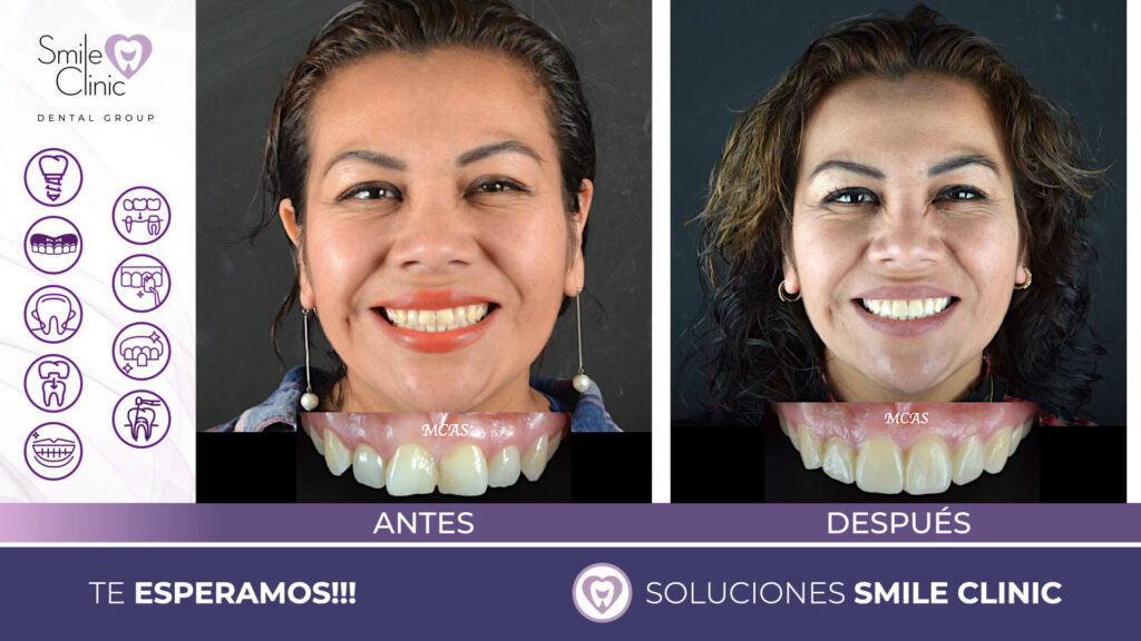 FOTOS ANTES Y DESPUES 2023.003