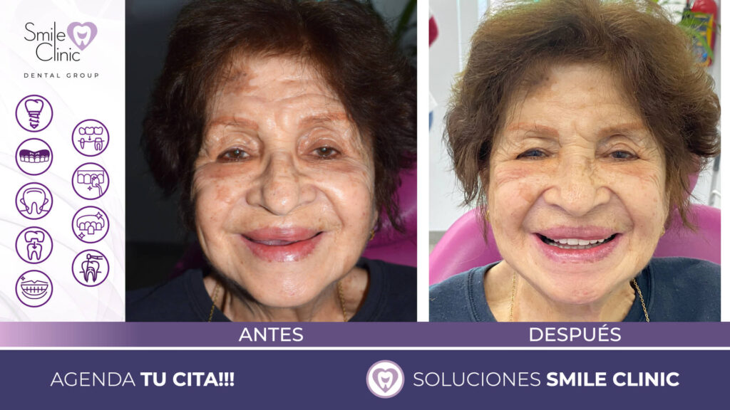 FOTOS ANTES Y DESPUES 2023.005