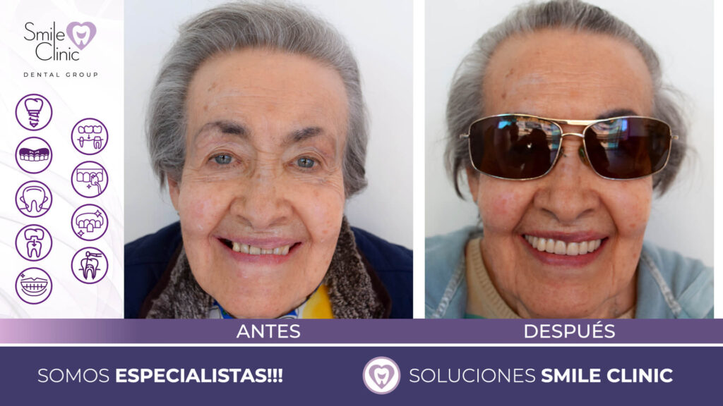 FOTOS ANTES Y DESPUES 2023.006