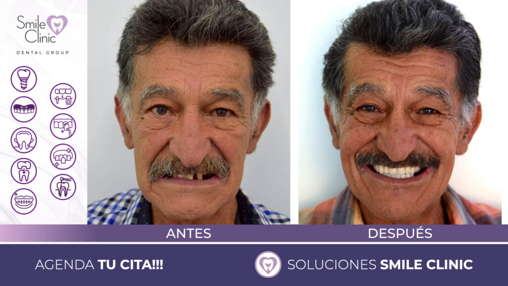 FOTOS ANTES Y DESPUES 2023.008