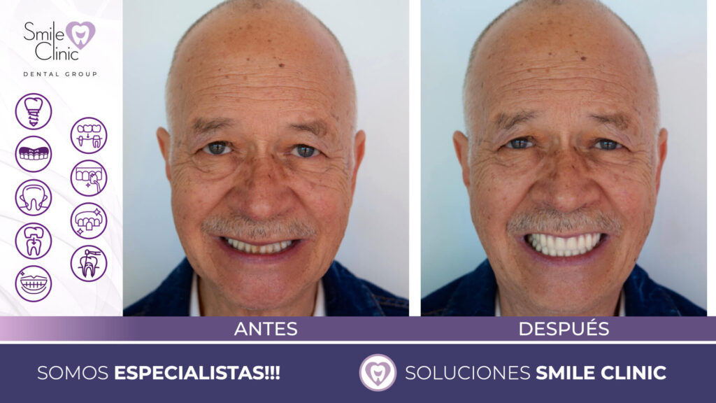 FOTOS ANTES Y DESPUES 2023.009