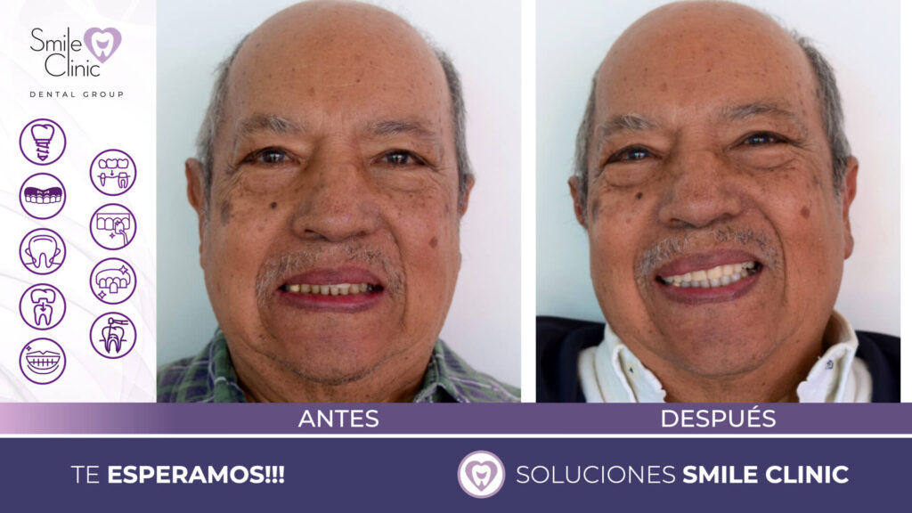 FOTOS ANTES Y DESPUES 2023.010